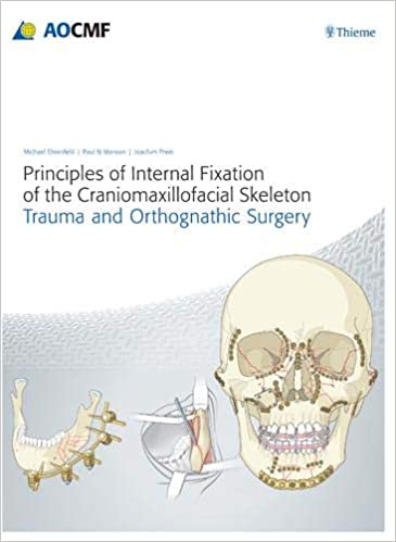 Principles of Internal Fixation of the Craniomaxillofacial Skeleton Trauma and Orthognathic Surgery