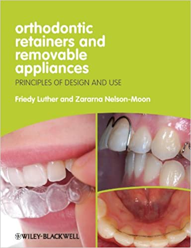 Orthodontic Retainers And Removable Appliances Principles Of Design And Use