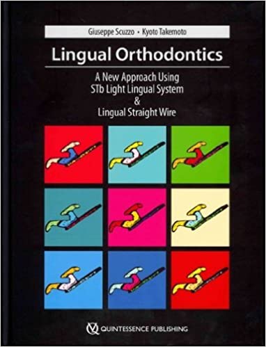 Lingual Orthodontics A New Approach Using Stb Light Lingual System & Lingual Straight Wire