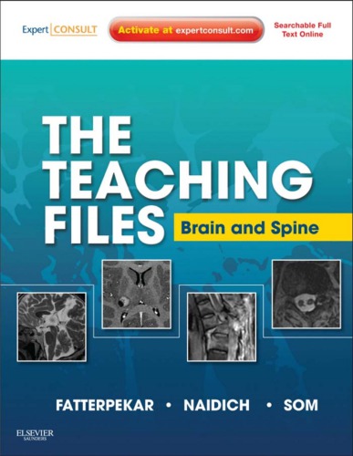 The Teaching Files Brain and Spine Imaging