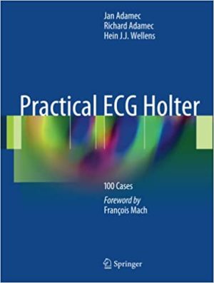 Practical ECG Holter 100 Cases