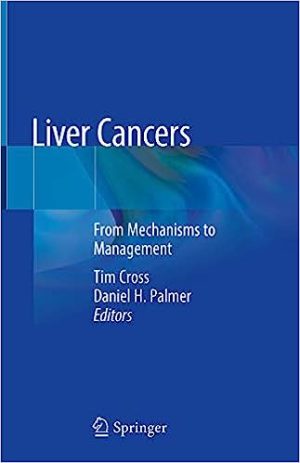 Liver Cancers From Mechanisms to Management