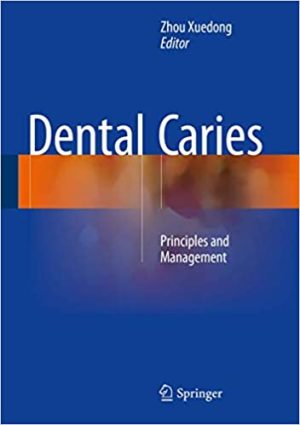 Dental Caries Principles and Management