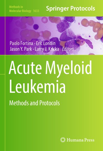 Acute Myeloid Leukemia Methods and Protocols