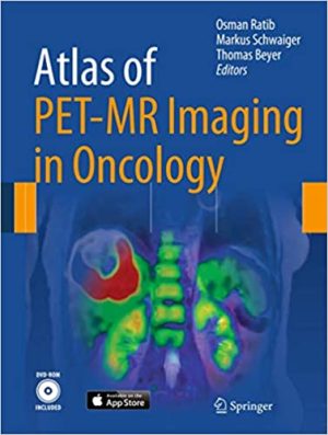 Atlas of PET MR Imaging in Oncology