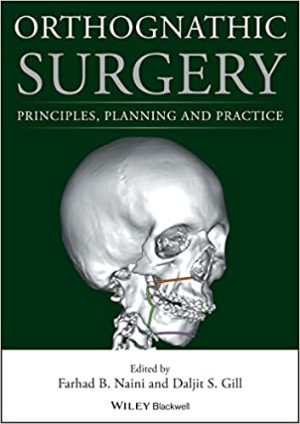 Orthognathic Surgery Principles Planning and Practice