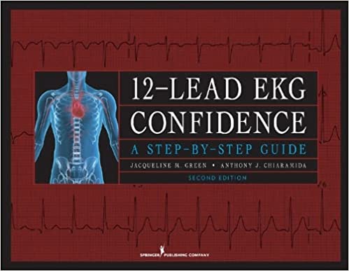 12 Lead EKG Confidence A Step By Step Guide
