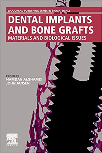 Dental Implants and Bone Grafts Materials and Biological Issues