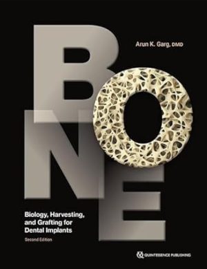 Bone Biology Harvesting and Grafting for Dental Implants 2nd Edition
