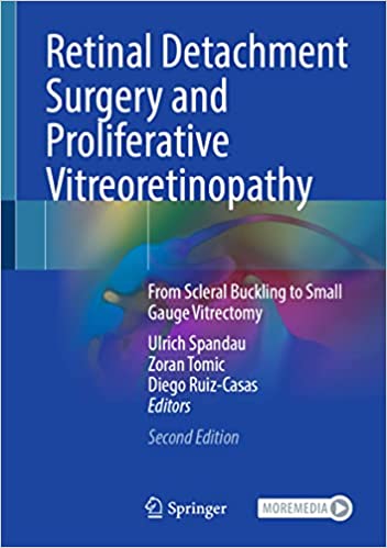 Retinal Detachment Surgery and Proliferative Vitreoretinopathy From Scleral Buckling to Small Gauge Vitrectomy 2nd Edition