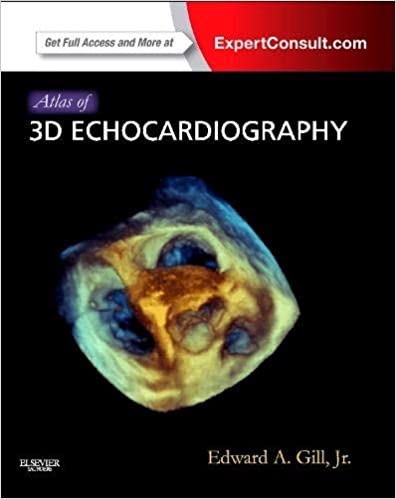 Atlas of 3D Echocardiography
