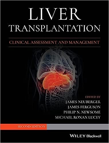 Liver Transplantation Clinical Assessment and Management