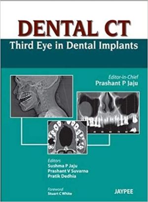 Dental CT Third Eye in Dental Implants