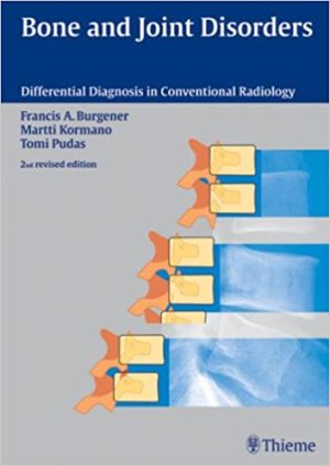 Bone and Joint Disorders 2nd Edition