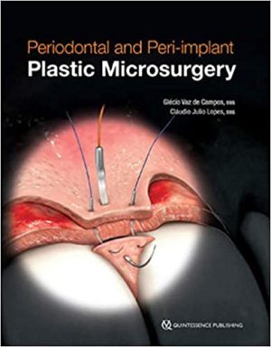 Periodontal and Peri implant Plastic Microsurgery Minimally Invasive Techniques with Maximum Precision