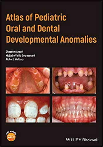 Atlas of Pediatric Oral And Dental Developmental Anomalies