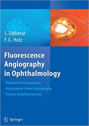 Fluorescence Angiography In Ophthalmology