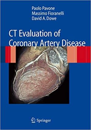 CT Evaluation of Coronary Artery Disease