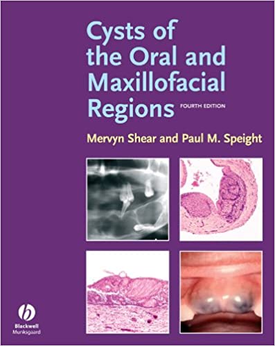 Cysts of the Oral and Maxillofacial Regions 4th Edition