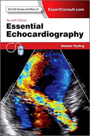 Essential Echocardiography 2nd Edition By Alisdair Ryding