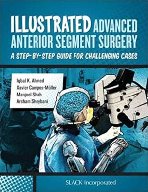 Illustrated Advanced Anterior Segment Surgery A Step by Step Guide for Challenging Cases