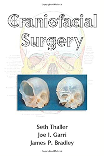 Craniofacial Surgery By Seth Thaller