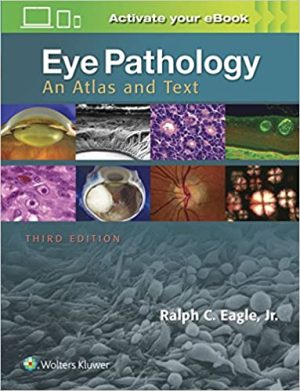 Eye Pathology An Atlas and Text 3rd Ed