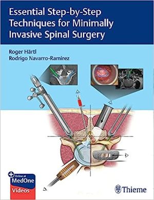 Essential Step by Step Techniques for Minimally Invasive Spinal Surgery