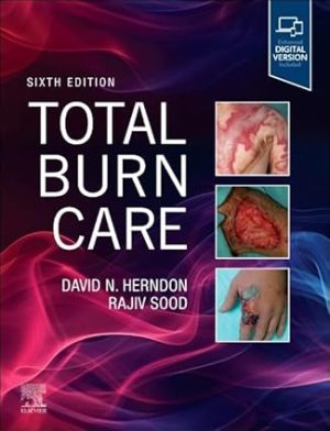 Total Burn Care 6th Edition