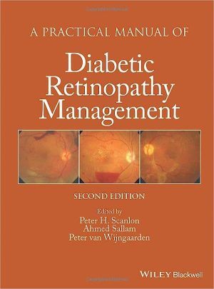 A Practical Manual of Diabetic Retinopathy Management 2nd Edition