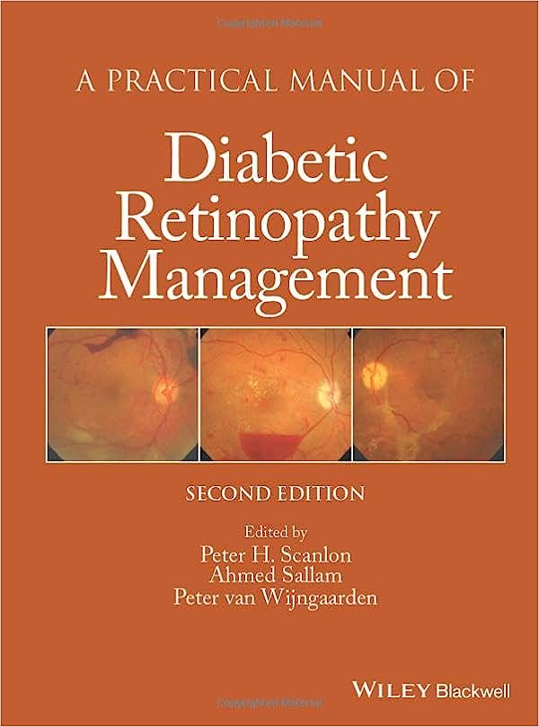 A Practical Manual of Diabetic Retinopathy Management 2nd Edition