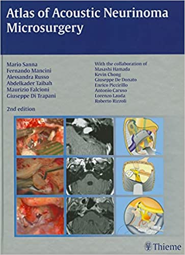Atlas of Acoustic Neurinoma Microsurgery 2nd Edition