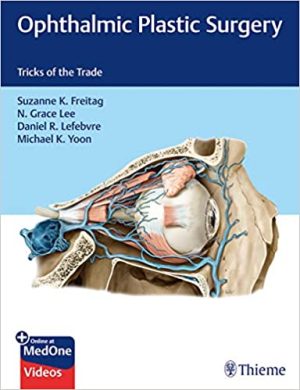 Ophthalmic Plastic Surgery Tricks of the Trade
