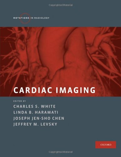 Cardiac Imaging
