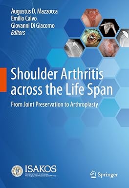 Shoulder Arthritis Across the Life Span From Joint Preservation to Arthroplasty