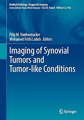 Imaging of Synovial Tumors and Tumor like Conditions