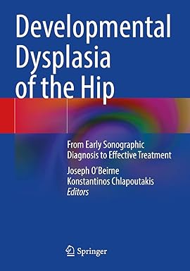 Developmental Dysplasia of the Hip From Early Sonographic Diagnosis to Effective Treatment