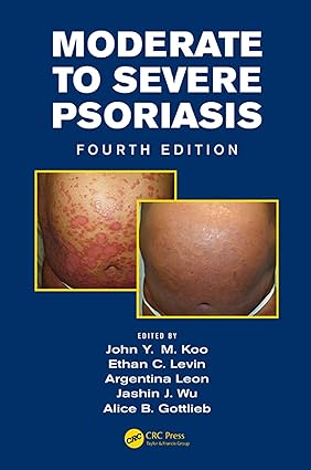 Moderate to Severe Psoriasis 4th Edition
