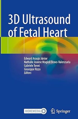 3D Ultrasound of Fetal Heart