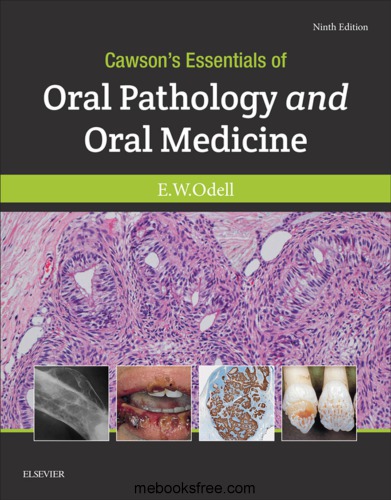 Cawsons Essentials of Oral Pathology and Oral Medicine 9th Ed