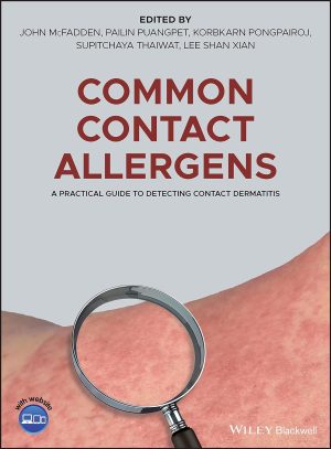 Common Contact Allergens A Practical Guide to Detecting Contact Dermatitis