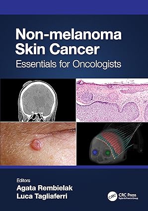 Non melanoma Skin Cancer Essentials for Oncologists