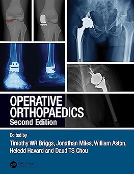 Operative Orthopaedics 2nd Edition By Timothy WR Briggs