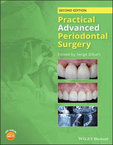 Practical Advanced Periodontal Surgery 2nd Edition