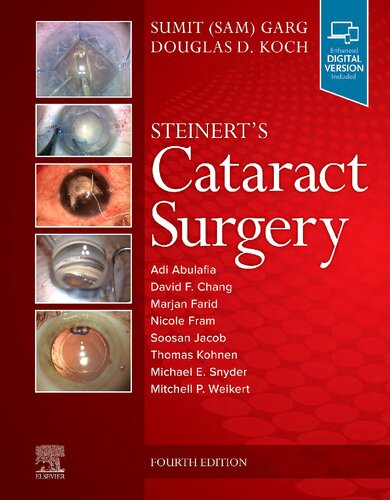 Steinerts Cataract Surgery 4th Edition