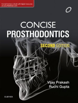 Concise Prosthodontics Prep Manual for Undergraduates 2nd Edition