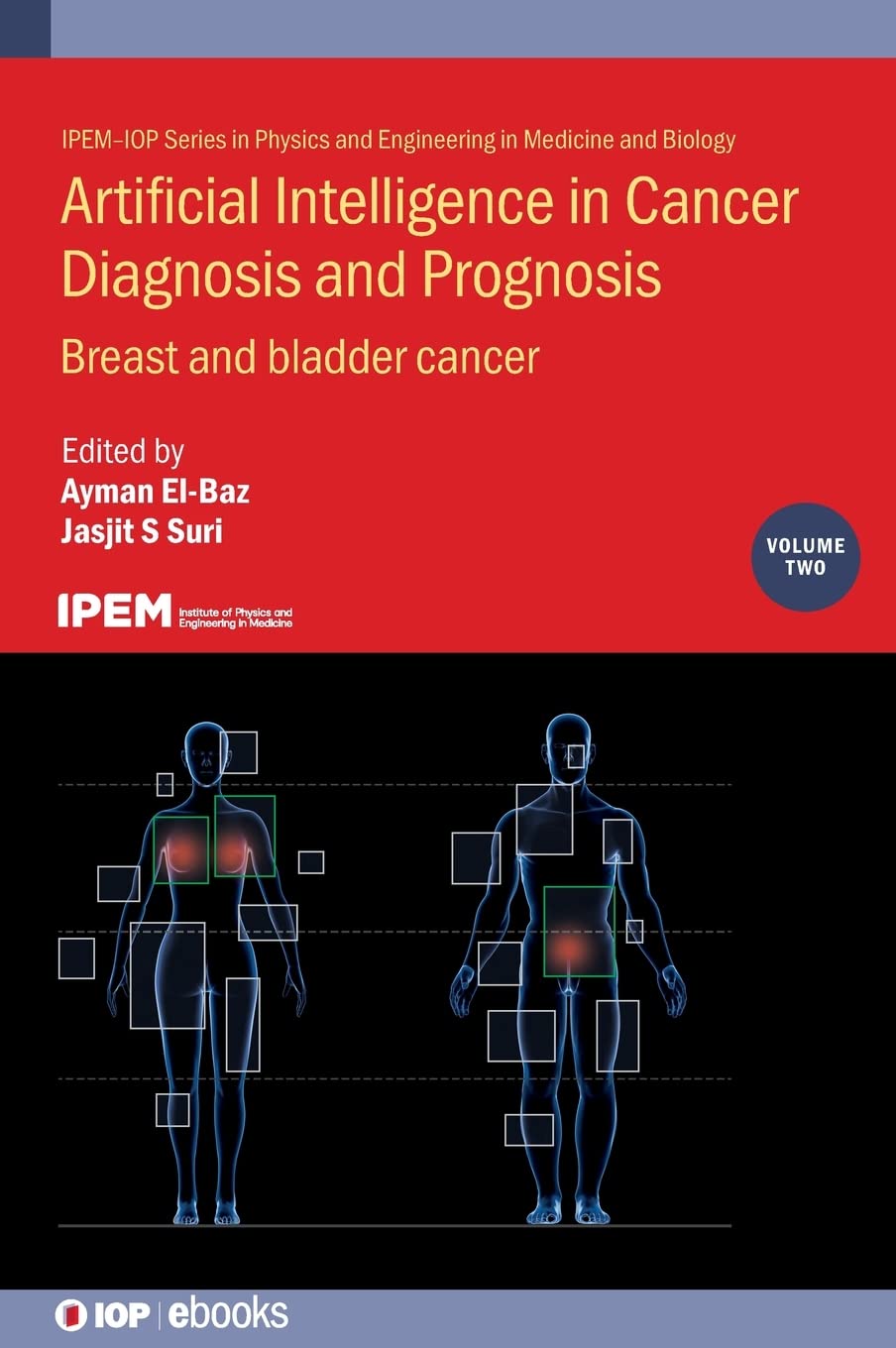Artificial Intelligence in Cancer Diagnosis and Prognosis Volume 2 Breast and Bladder Cancer