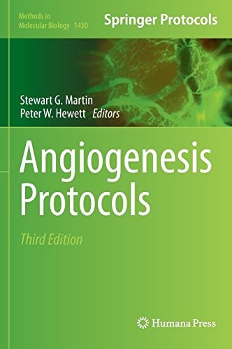 Angiogenesis Protocols 3rd Edition