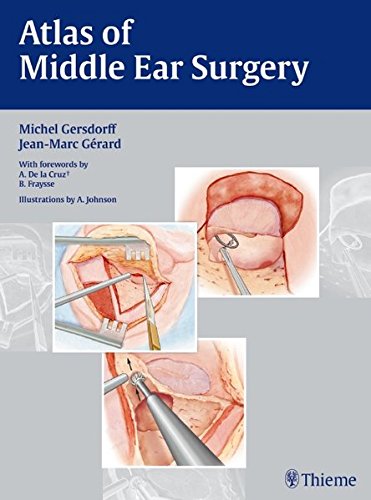Atlas of Middle Ear Surgery
