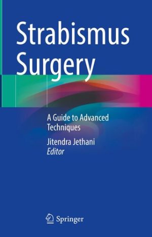 Strabismus Surgery A Guide to Advanced Techniques